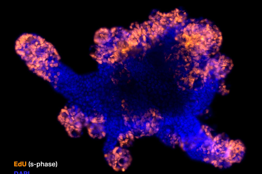EdU_organoid_rg