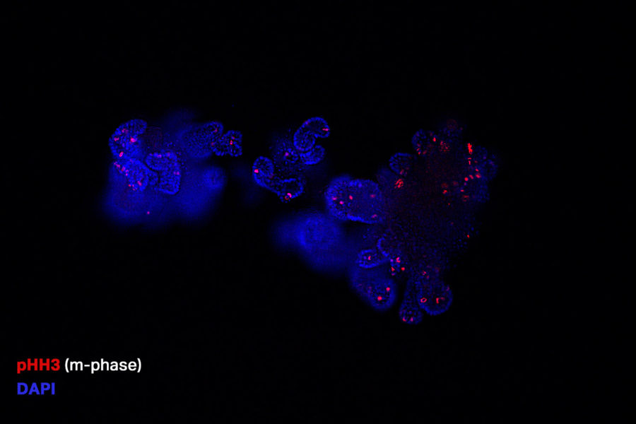 pHH3_organoid_rg_A
