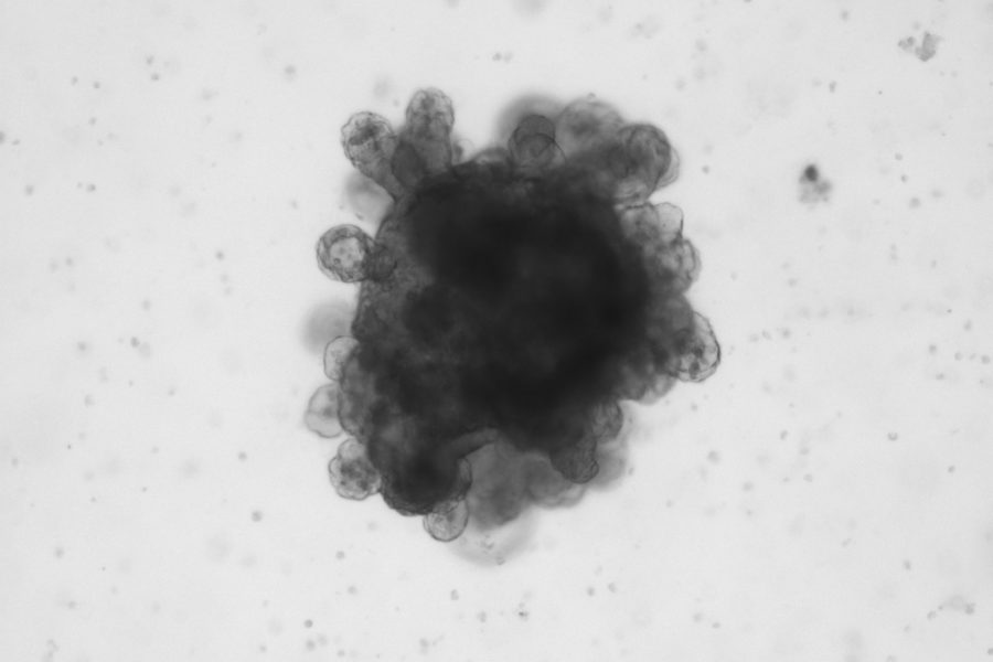 intestinal organoid